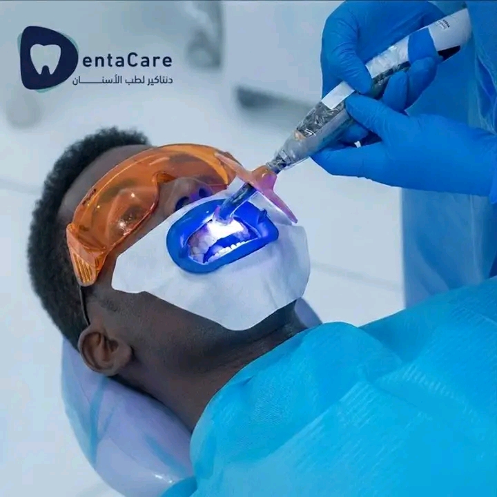 تبييض الأسنان